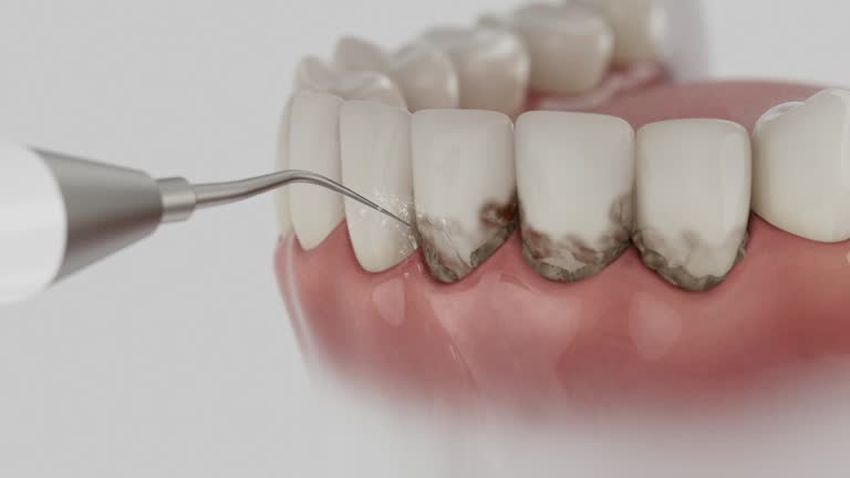 Reliable Dental contractor in Montello, WI by Smile Center Dentistry